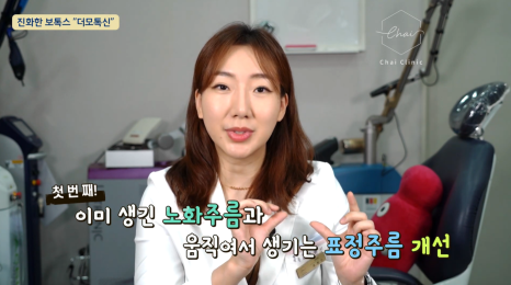 스킨보톡스 효과? 즉각적으로 체감할 수 있어요! 관련 이미지 6