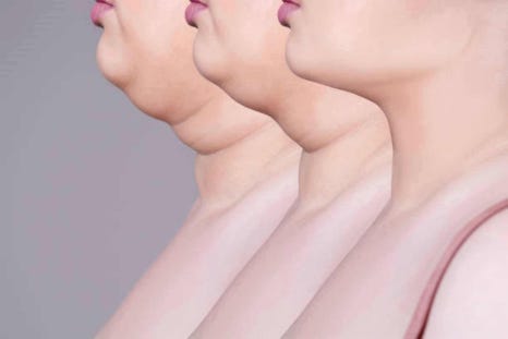 브이라인 주사, 달덩이 얼굴이 반쪽 되는 비결? 관련 이미지 3