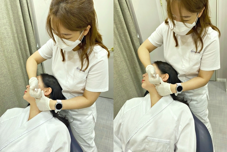 사각보톡스 불룩한 턱선을 V라인 얼굴로 관련 이미지 5
