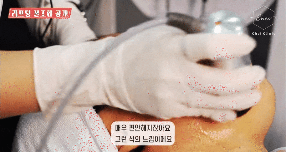 V라인리프팅 후기만 보고 결정하지 마세요! 관련 이미지 16