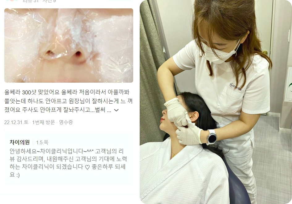 피코레이저 가격, 색소침착을 효과적으로 개선 하고 싶다면 관련 이미지 18