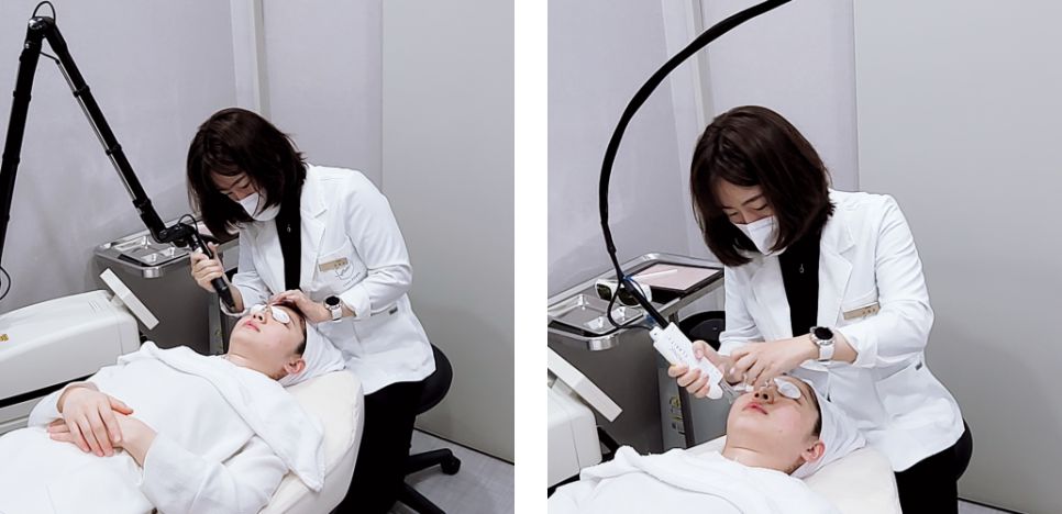 색소침착레이저토닝, 밝은 피부를 위해 관련 이미지 6