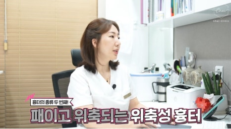 여드름흉터치료의 핵심은 바로 &lsquo;이것&rsquo; 관련 이미지 4