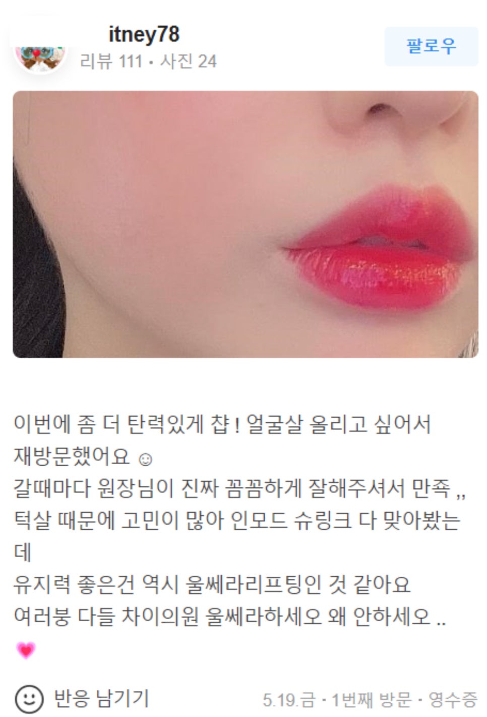 팔자주름 실리프팅 늘어지고 처진 피부를 당겨요! 관련 이미지 16