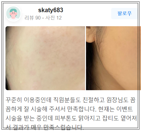 합정 모노실리프팅 어머니 나이를 8살 되돌리는 비결? 관련 이미지 8