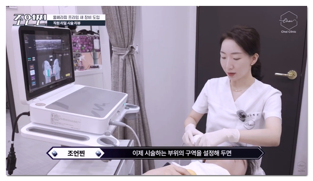 Criteria for Choosing a Good Ulthera Clinic in Hongdae image 6