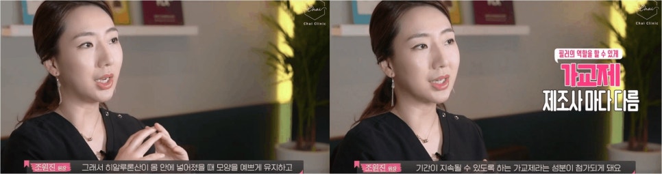 국산필러종류 무엇으로 선택할지 고민될 때! 관련 이미지 5
