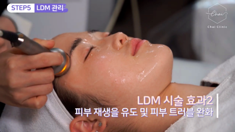 블랙헤드 피부 관리, 아피니트로 모공 청소하세요! 관련 이미지 10