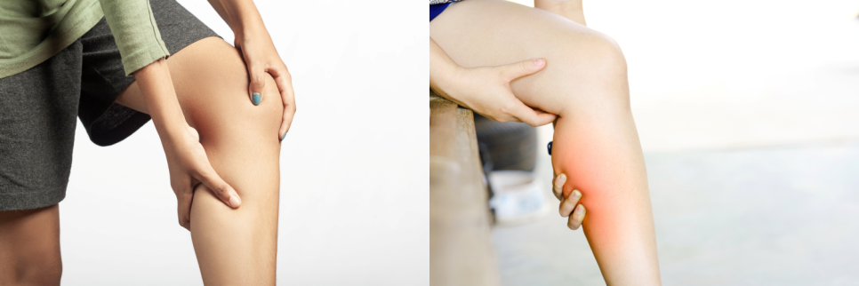 종아리보톡스 슬림한 다리 라인 원한다면! 관련 이미지 5
