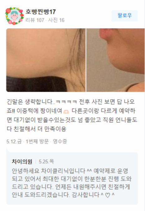 홍대윤곽주사 올여름 이중턱과 이별하기 관련 이미지 14