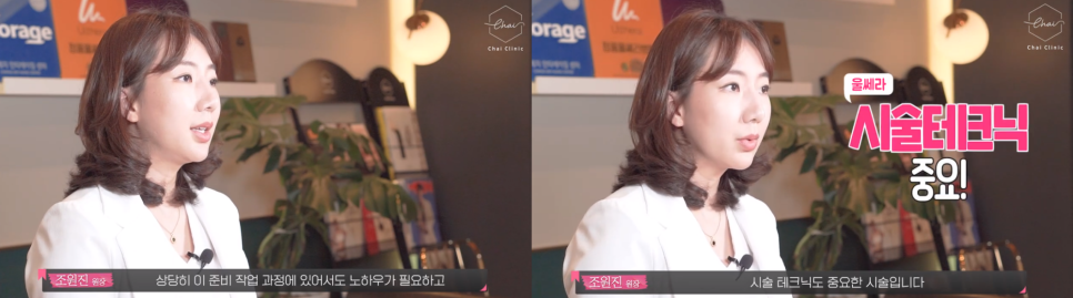 울쎄라 수면마취 없이 원장이 직접 시술받은 후기 관련 이미지 5