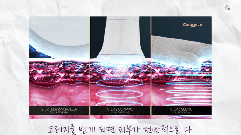 연어주사효과 리쥬란힐러에 대한 모든 것! 관련 이미지 8