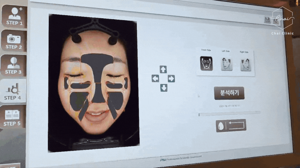 홍대 리쥬란힐러 잘하는 곳 2가지만 보세요 관련 이미지 2