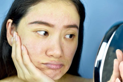합정 클라리티 레이저 하나로 모든 피부 고민 해결! 관련 이미지 1