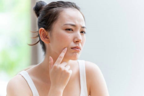 피부관리레이저종류 합정 울써마지까지 한방에 정리! 관련 이미지 1