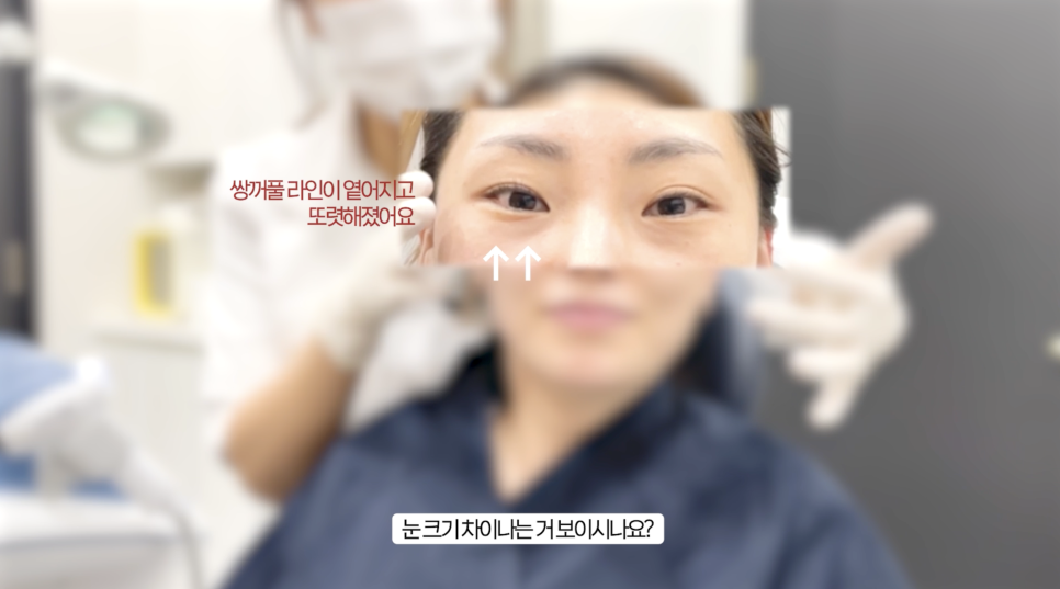 슈링크 유니버스 효과를 높이는 레이어 리프팅 관련 이미지 8