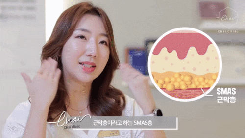 연희동 울쎄라 여배우들도 찾는 리프팅 시술! 관련 이미지 2