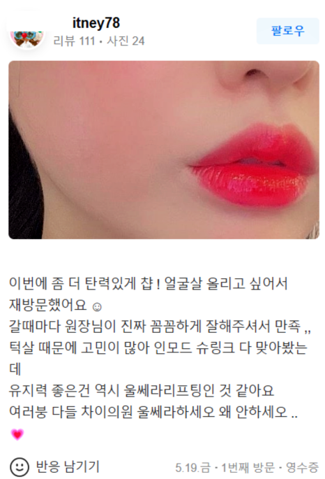 팔자주름보톡스 A부터 Z까지 파헤쳐 드려요 관련 이미지 16
