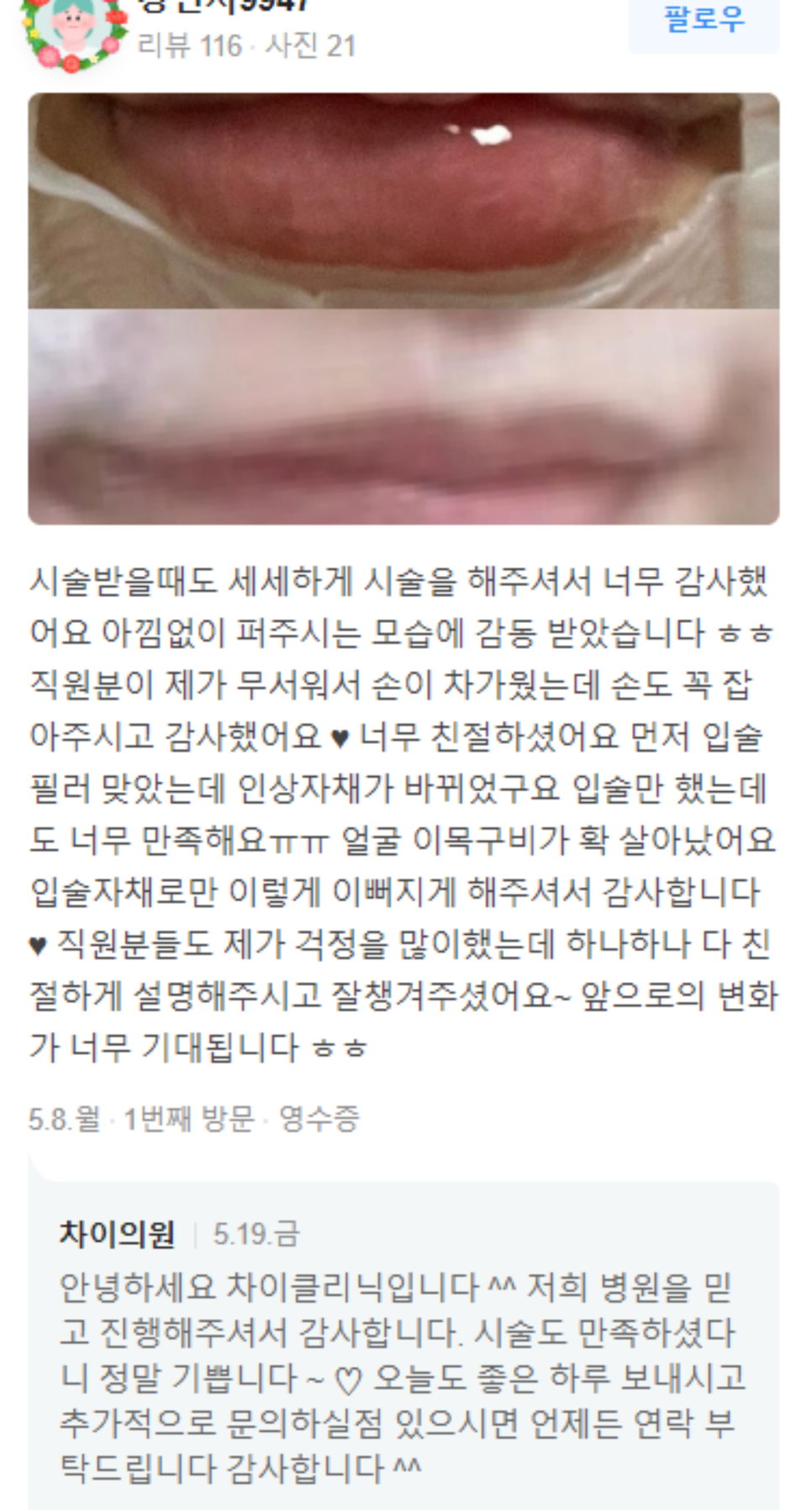겨드랑이 레이저토닝 자신있게 핸즈업하려면 지켜야 할 것 관련 이미지 10