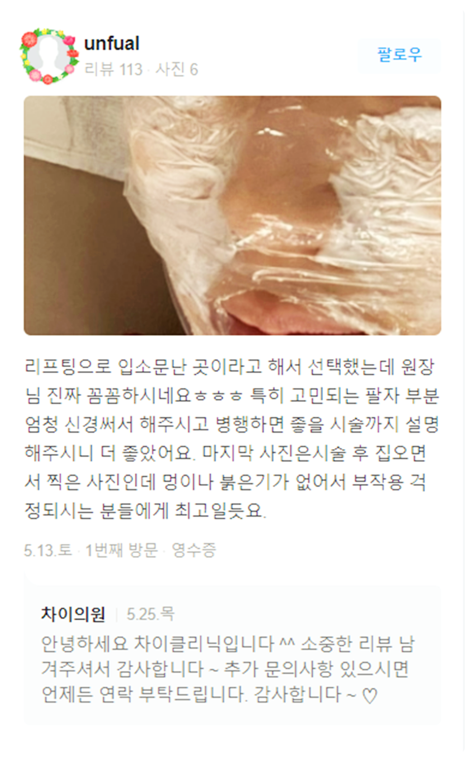 아이슈링크 눈가 주름 없는 동안 피부로 관련 이미지 20
