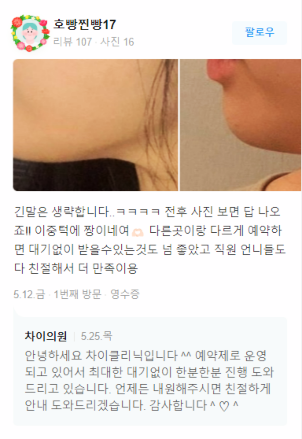응암역피부관리, 피부맛집 찾는 2가지 방법 관련 이미지 13