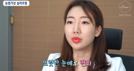 눈가탄력 20대로 돌아가고 싶다면 확인! 관련 이미지 5