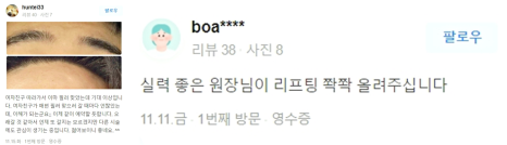 여드름흉터제거 이 글 하나로 관련 이미지 10