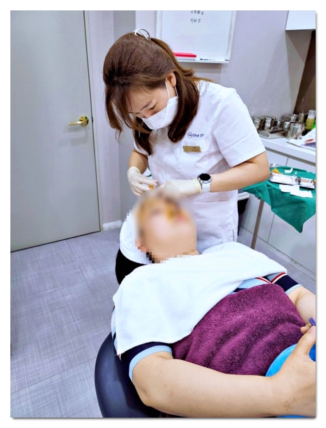 Why the Face Can Look Bigger If Temple Filler Is Done Wrong in Hongdae image 5