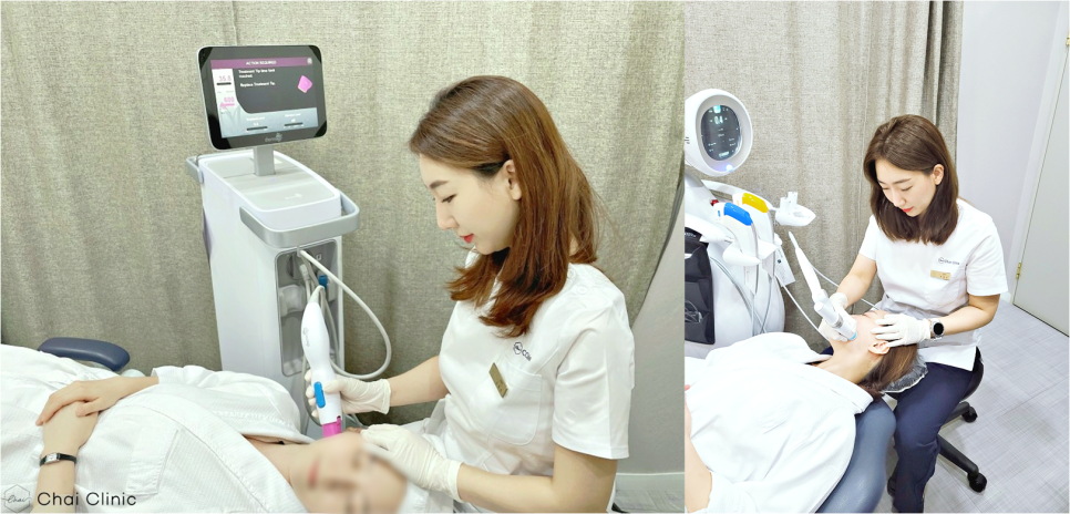 여드름흉터제거 이 글 하나로 관련 이미지 4
