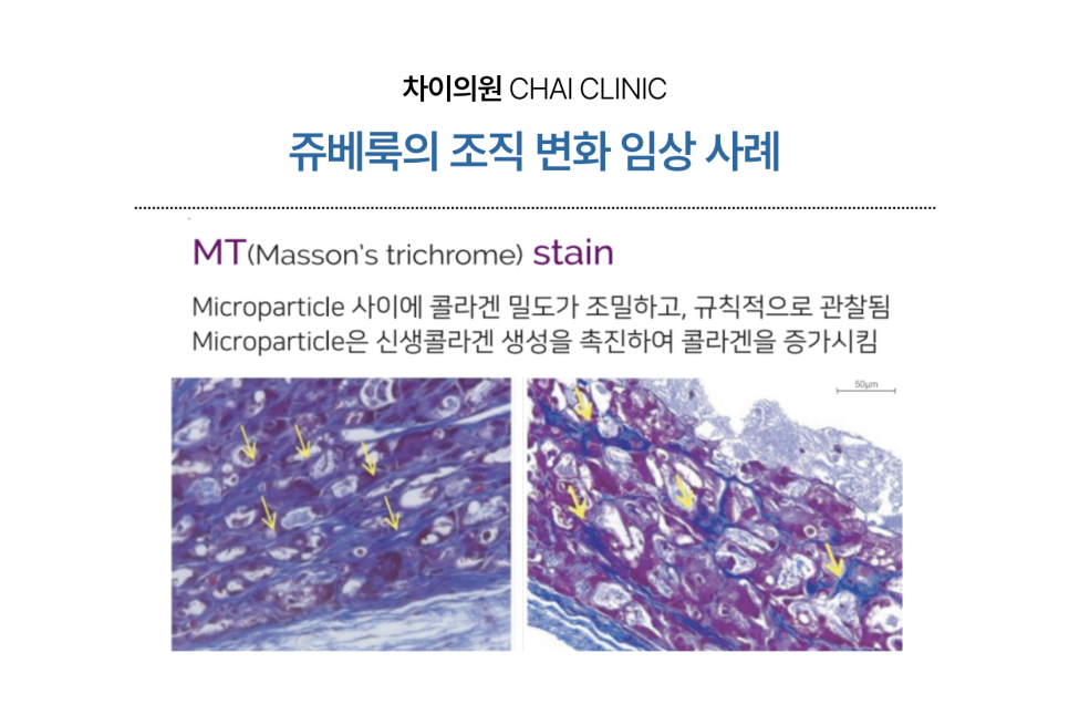 쥬베룩 성분에 따른 콜라겐 생성 촉진 효과 관련 이미지 2