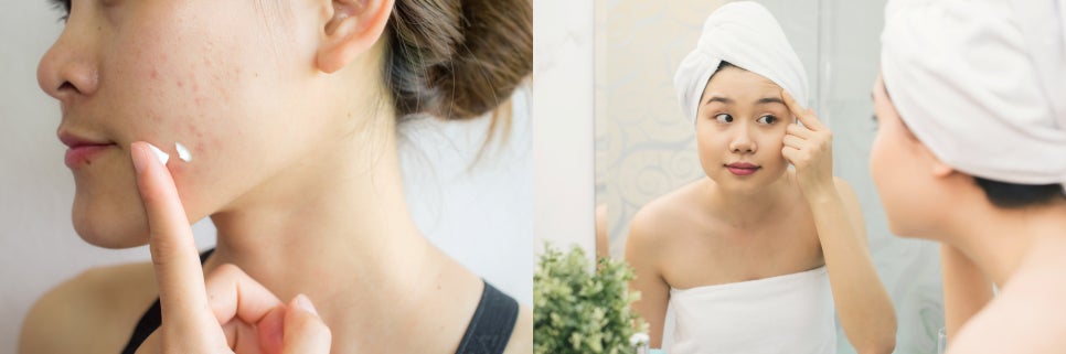 상암동피부관리, 3살 어려지는 마법을 경험하실거예요~ 관련 이미지 2
