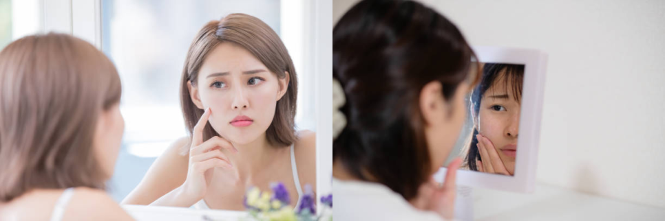 V라인주사, &lsquo;OO&rsquo;를 이루는 것이 중요합니다. 관련 이미지 6