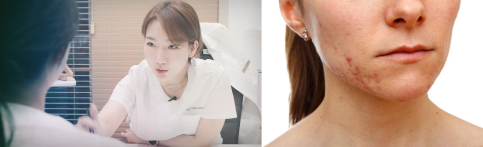 당산피부관리 어디로 가야할지 모르겠다면 관련 이미지 1