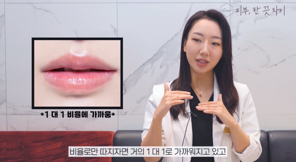 Hongdae Lip Filler: A Complete Guide to Pain, Swelling, and Design Before and After image 3
