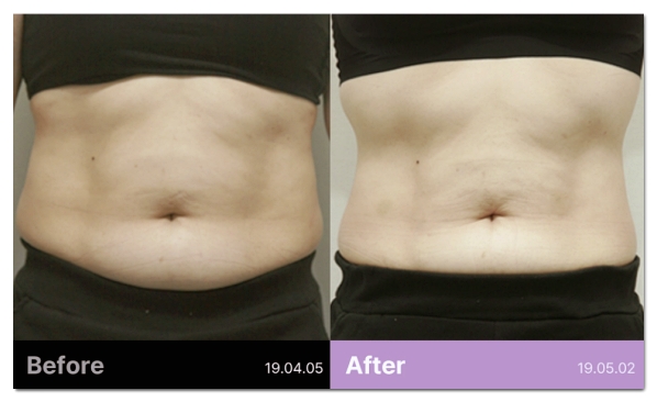 5 Things to Check Before Starting a Diet in Hapjeong image 4