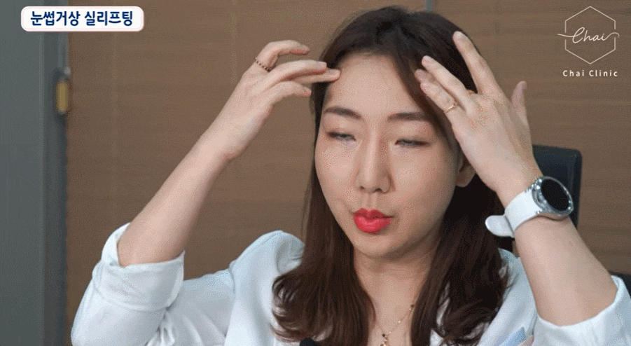 팔자주름시술? 자연스럽게 효과보는 방법 관련 이미지 4