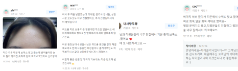 콧등주름, 보톡스로 효과 보기 위한 2가지 꿀팁 관련 이미지 11