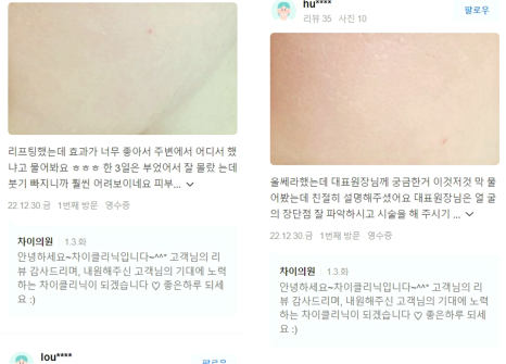 이중턱실리프팅해도 &lsquo;내가 원하는 효과&rsquo;를 얻지 못하는 이유 쉽게 설명해드립니다. 관련 이미지 15