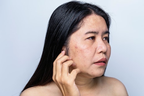 써마지600샷가격? 가격보다 중요한 OO 관련 이미지 2