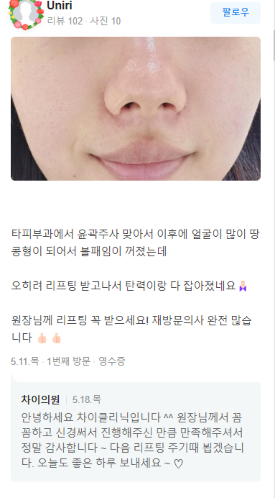 스킨부스터 종류? 나에게 딱 맞는 원픽 찾는법 관련 이미지 17
