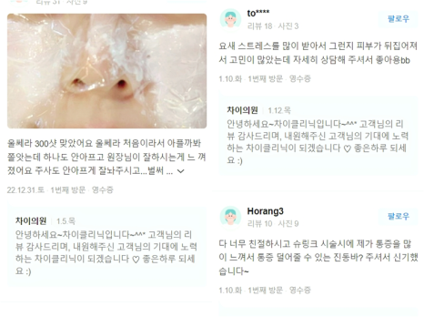 리프팅종류와 원리 부위별리프팅 선택방법 관련 이미지 11