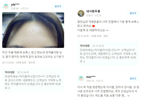 눈썹리프팅 수술 없이 시원한 눈매 완성하는 방법 관련 이미지 14