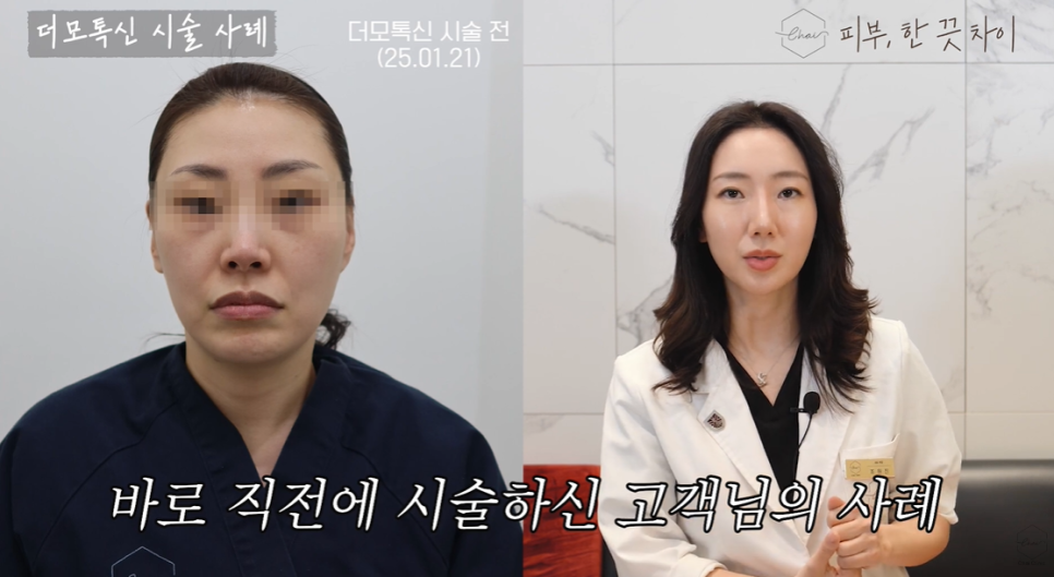 Hongdae Skin Botox Side Effects and 3 Precautions for the Procedure image 2