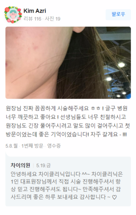 브이라인주사 달덩이 같던 얼굴이 반쪽으로! 관련 이미지 19