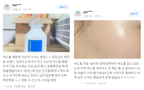 처진볼살 리프팅 힘있는 탄력으로 어려지는 피부 관련 이미지 14