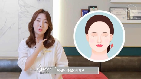 피부관리울쎄라 탄력있는 리프팅? 더 잘 받는 방법 관련 이미지 17