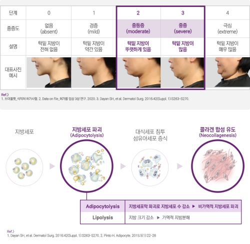 이중턱주사 맞기 전에 반드시 관련 이미지 5