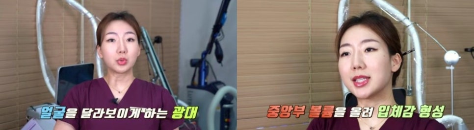 팔자주름시술? 자연스럽게 효과보는 방법 관련 이미지 3