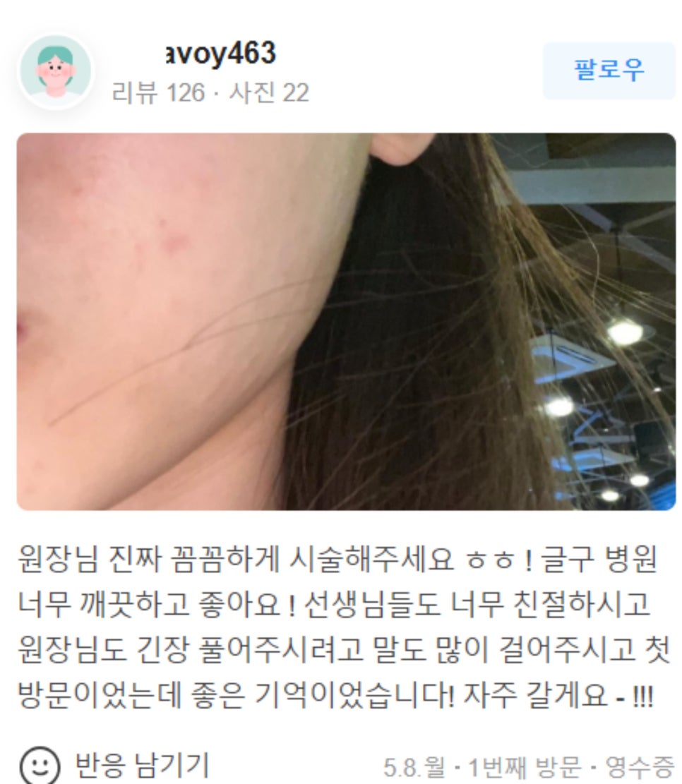 팔자주름 실리프팅 늘어지고 처진 피부를 당겨요! 관련 이미지 21