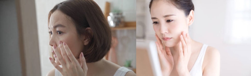 합정역 피부관리 피부탄력 시술의 차이, 알아야 효과있다 관련 이미지 6